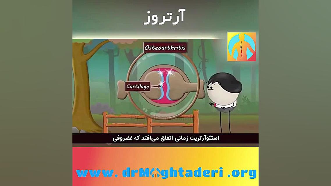 آرتروز چیست؟ دکتر علیرضا مقتدری | متخصص طب فیزیکی