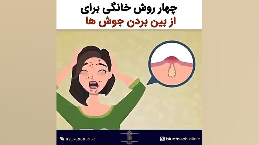 چند روش خانگی برای درمان جوش رفع افتادگی پلک