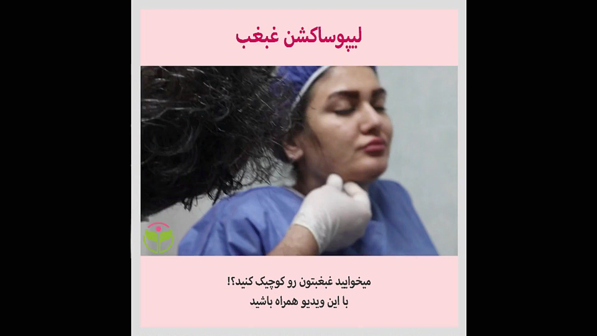 لیپوساکشن غبغب ربات جراحی داوینچی