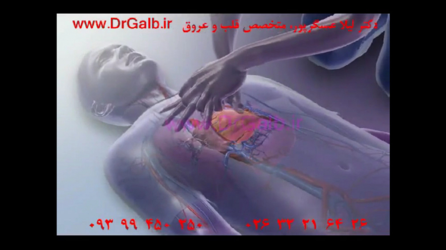احیا قلبی و ریوی CPR لیپوماتیک