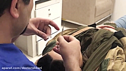 آموزش چسب زدن بینی بعد از جراح...