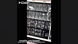 کلیپ پزشکی-جراحی تومور نخاع توسط دکتر میرسعید،پزشک جراح مغز و اعصاب  ترند روز