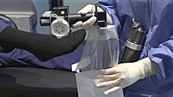 AssistArm™ for Ankle Procedure...