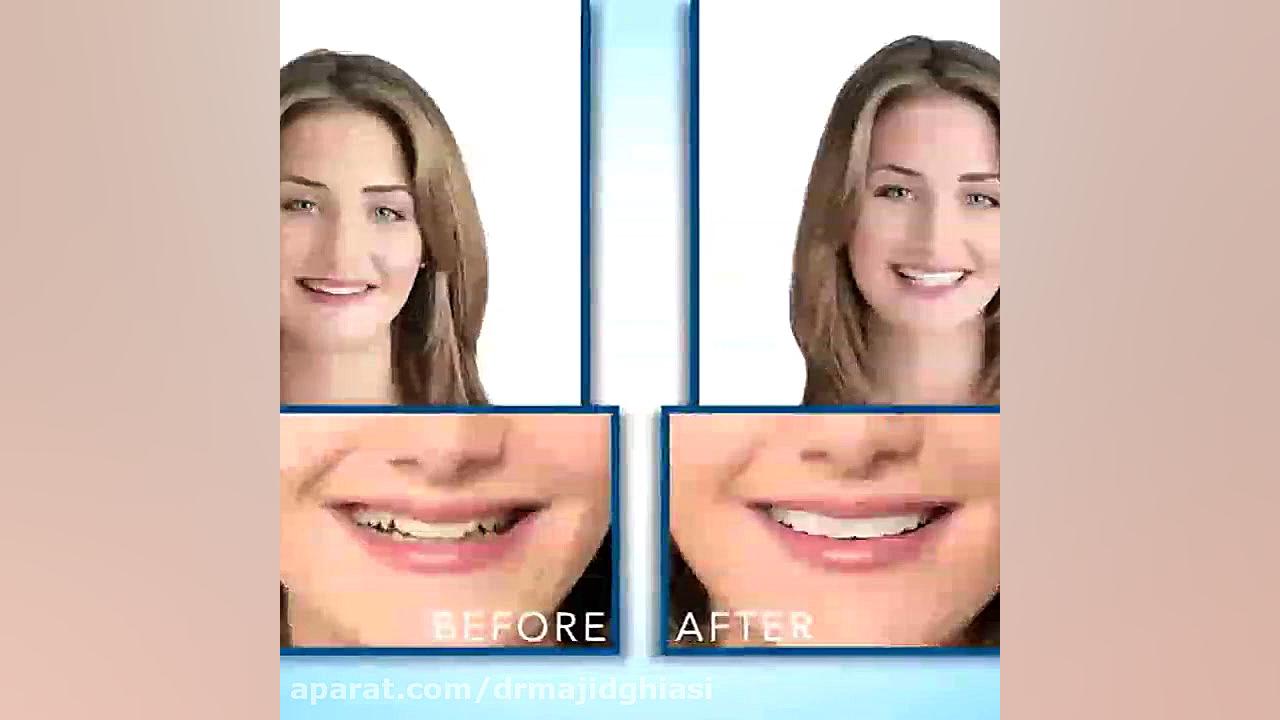 دکترمجیدقیاسی-دندانپزشک زیبایی مشهد دکترمجیدقیاسی