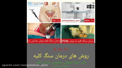 روش های درمان سنگ کلیه