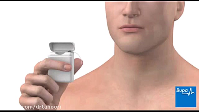 نخ دندان کشیدن-مرکزدندانپزشکی فوق تخصص ایمپلنت و زیبایی پردیسwww.pardisdental.ir لنز تماسی دارورسان