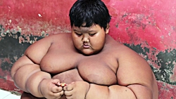 چاق ترین پسر دنیا بالاخره لاغر شد