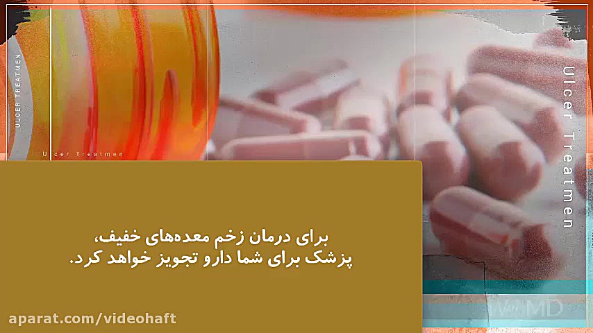 درمان زخم معده کشیدن دندان