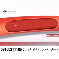 سریع ترین راه درمان فشار خون و راه های قطعی پیشگیری