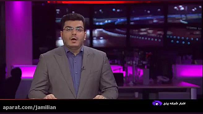 درمان عقب ماندگی فک با ارتودنسی / متخصص ارتودنسی / دکتر جمیلیان دکتر عبدالرضا جمیلیان - متخصص ارتودنسی