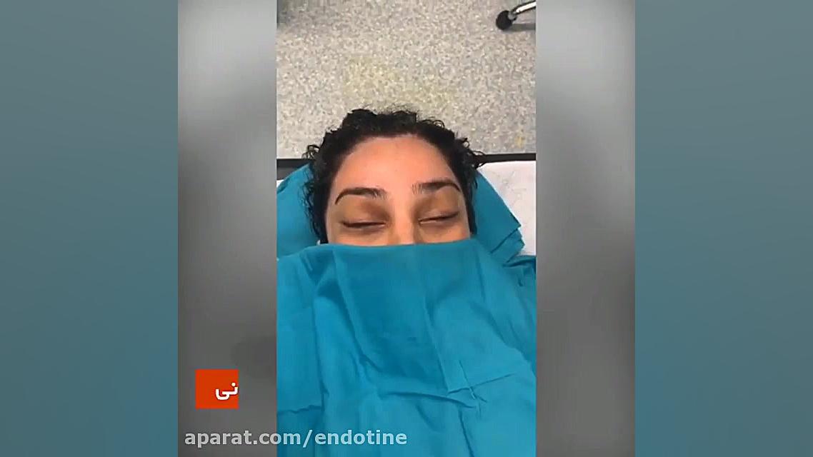 لیفت ابرو با اندوتاین توسط دکتر مجید نداف کرمانی هایپوفلکسی