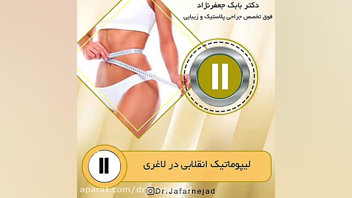 لیپوماتیک انقلابی در لاغری دکتر بابک جعفرنژاد