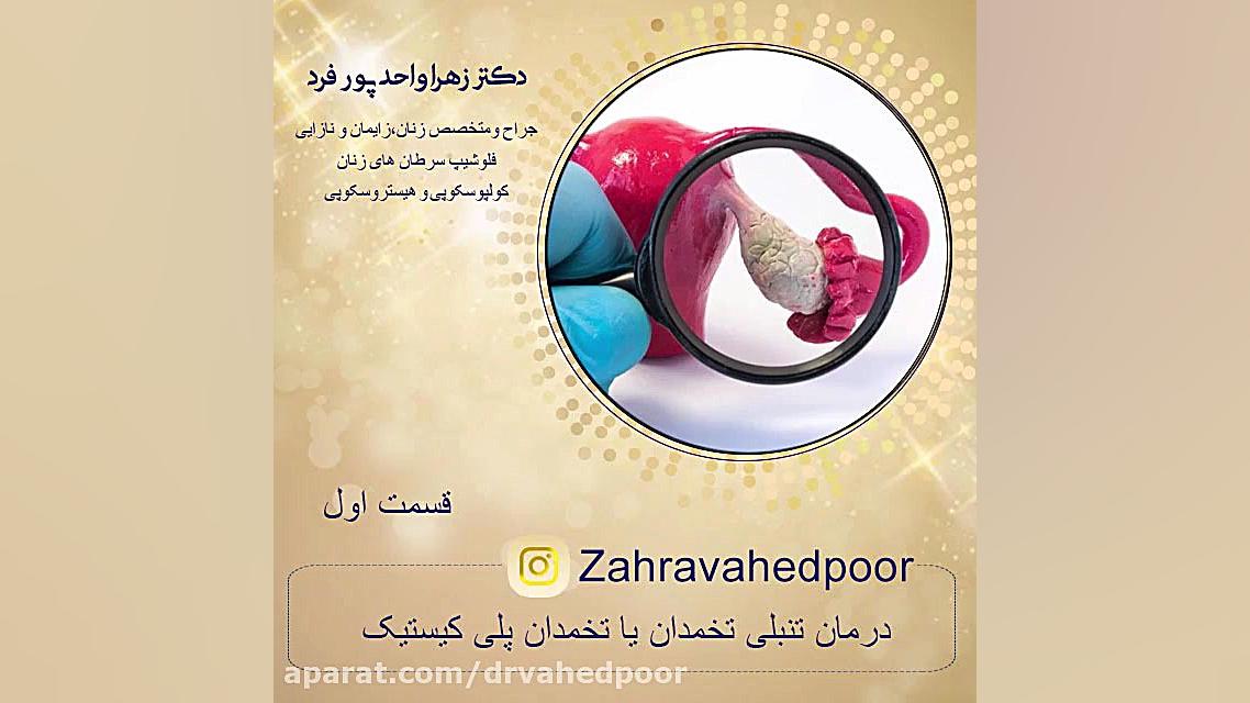 تنبلی تخمدان یا سندرم تخمدان پلی کیستیک دکتر پوست