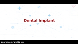 Dental implant Promotional teaser