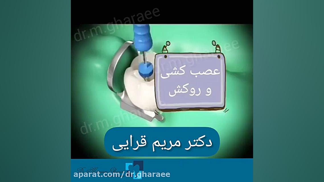 عصب کشی و روکش دندان دکتر مریم قرایی
