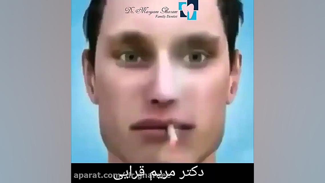 عوارض مصرف سیگار روی دندان دکتر مریم قرایی