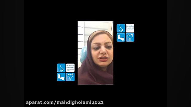 رضایت از عمل جراحی بینی - Rhinoplasty دکتر مهدی غلامی