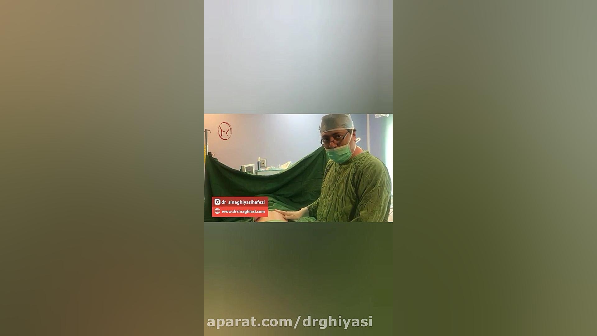 پروتز زیبایی برای سینه های صاف دکتر سینا غیاثی حافظی