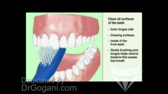 آموزش بهداشت دهان و دندان با دکترگوگانی تزریق ژل