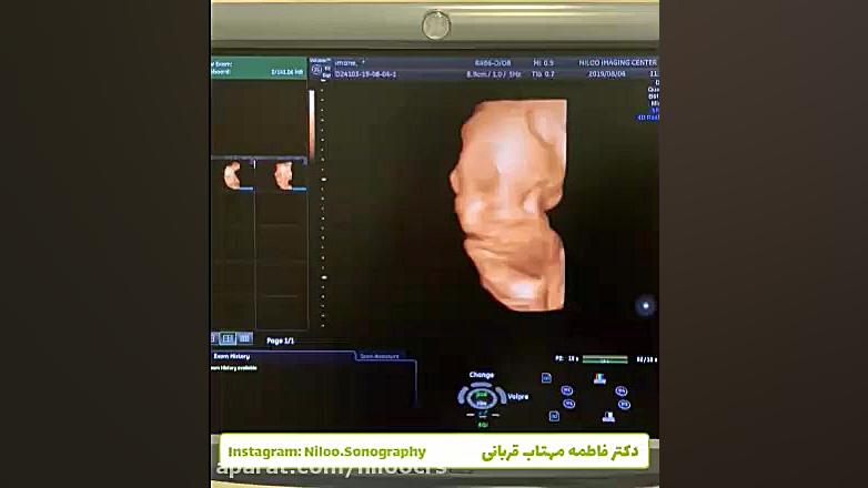 کنترل وزن جنین در هفته های آخر بارداری سونوگرافی نیلو دکتر فاطمه مهتاب قربانی