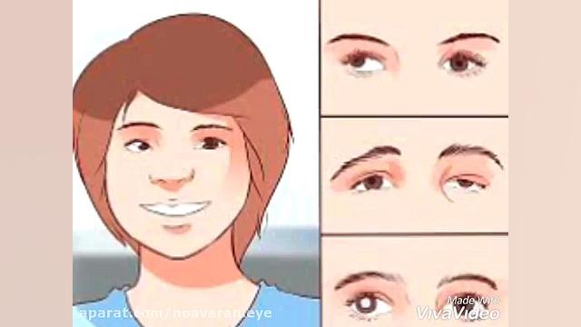 علل نیستاگموس چیست؟ کشیدن دندان