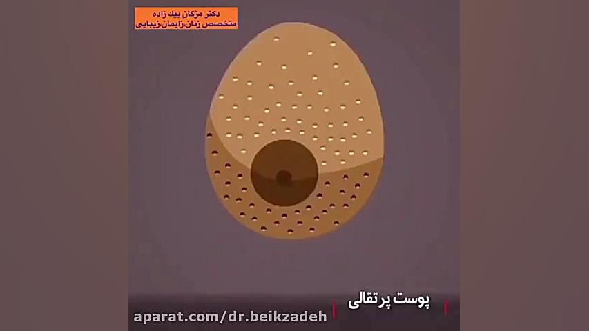 ظاهر سینه ها و تشخیص سرطان پستان دکتر مژگان بیک زاده ( جراح و متخصص زنان و زایمان)