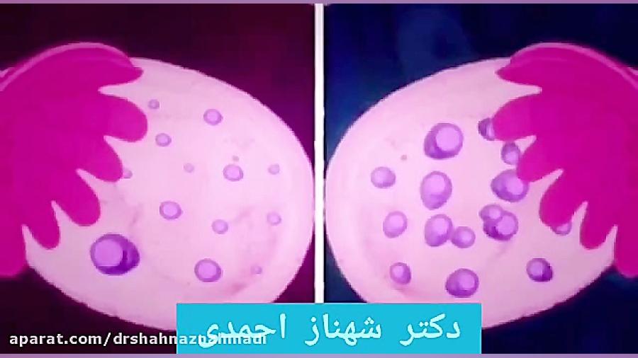 تفاوت بارداری طبیعی با IVF دکتر شهناز احمدی