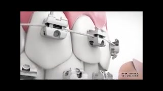 براکت ارتودنسی دکتر سهیل سالاری