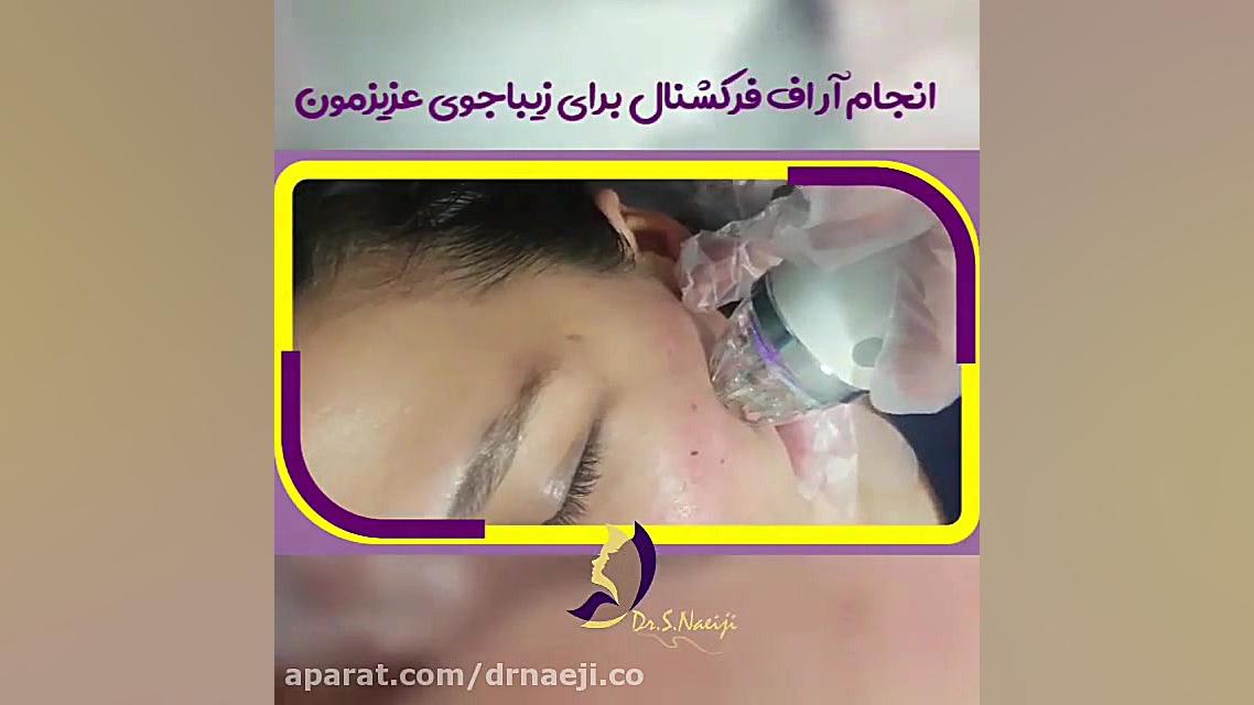 فیلم انجام لیزر آر.اف فرکشنال Super Resolution Microscopy