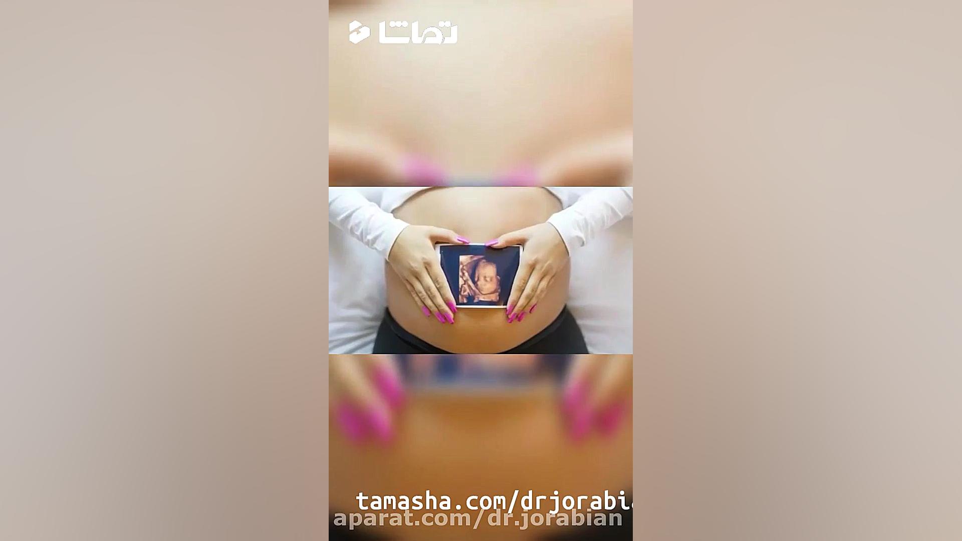 سونوگرافی سه بعدی جنین برداشتن خال