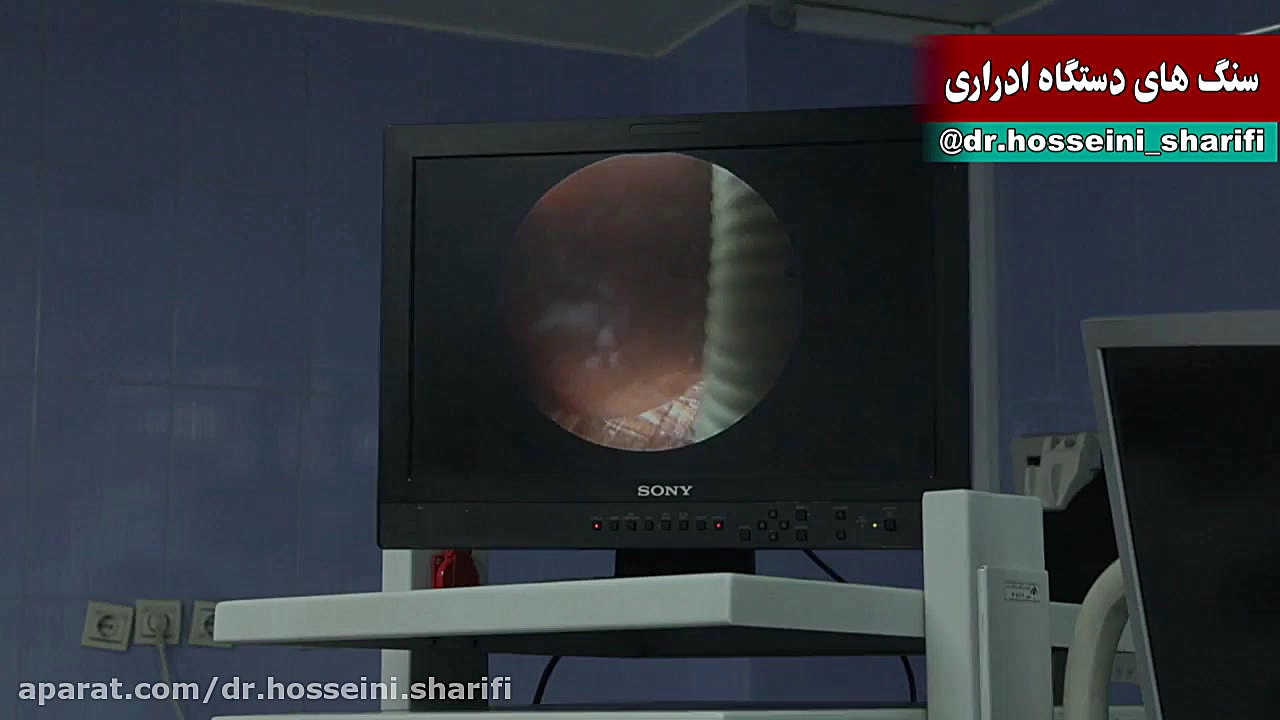 جراحی بسته سنگ کلیه ( PCNL ) - دکتر سید حسین حسینی شریفی ارولوژیست دکتر سید حسین حسینی شریفی فوق تخصص ارولوژی