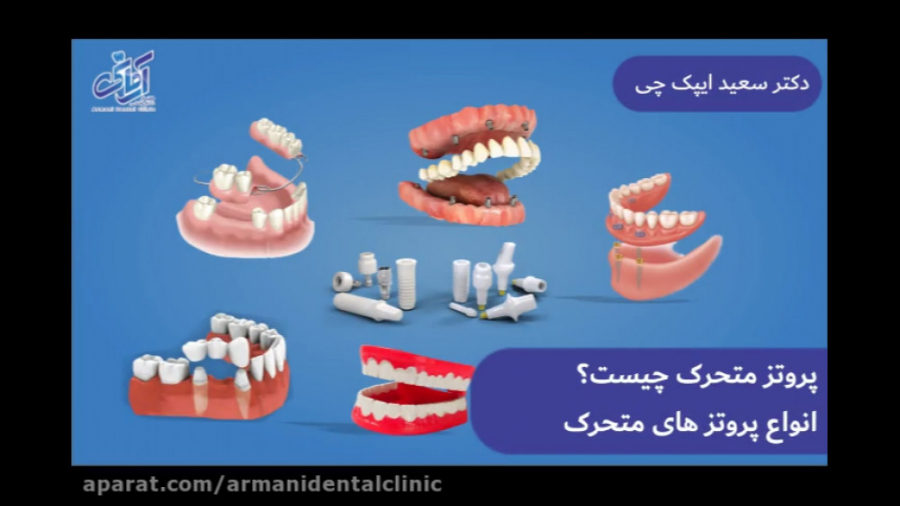 پروتز متحرک دندان چیست ؟ (دکتر سعید ایپک چی متخصص پروتزهای دندانی) آکنه