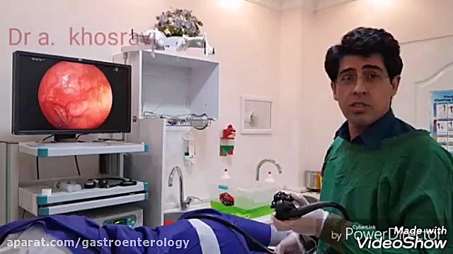 تشخیص آپاندیس برگشت خورده در بیمار با کولونوسکوپی توسط دکتر اصغر خسروی بلیچینگ
