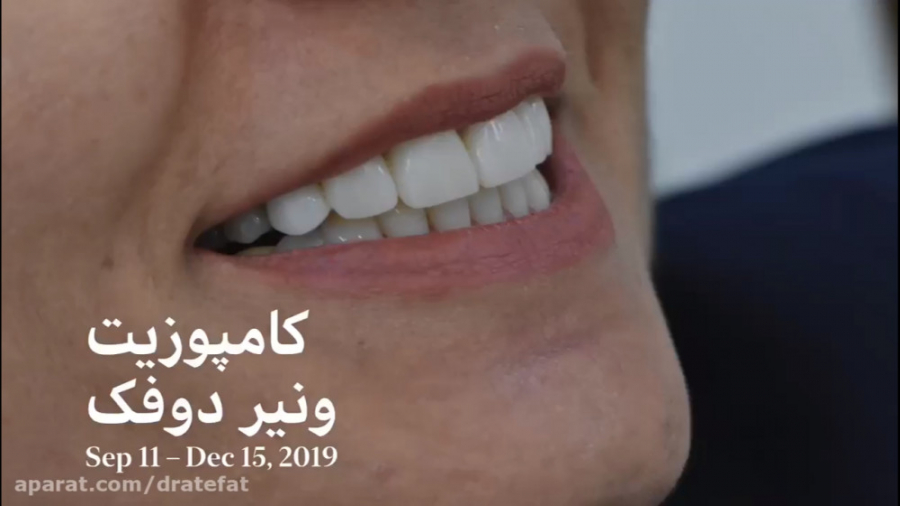 متخصص دندانپزشکی ترمیمی زیبایی اصفهان_دکتر محمد عاطفت دکتر محمد عاطفت متخصص ترمیمی و زیبایی اصفهان