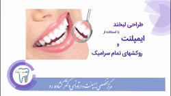 طراحی لبخند با استفاده از ایمپلنت و روکشهای تمام سرامیک کلینیک دندانپزشکی دکتر عزیز گشاده رو