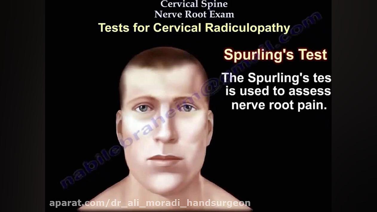 Cervical Discopathy Disease-1 (دیسکولوپاتی گردنی) دکتر علی مرادی جراح دست