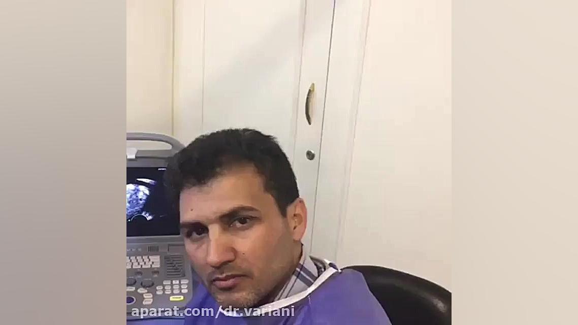 نمونه برداری از پروستات با توضیحات دکتر محسن وریانی (قسمت دوم) میکرونیدلینگ