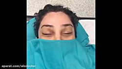 الو دکتر لیفت ابروی اندوسکوپیک...