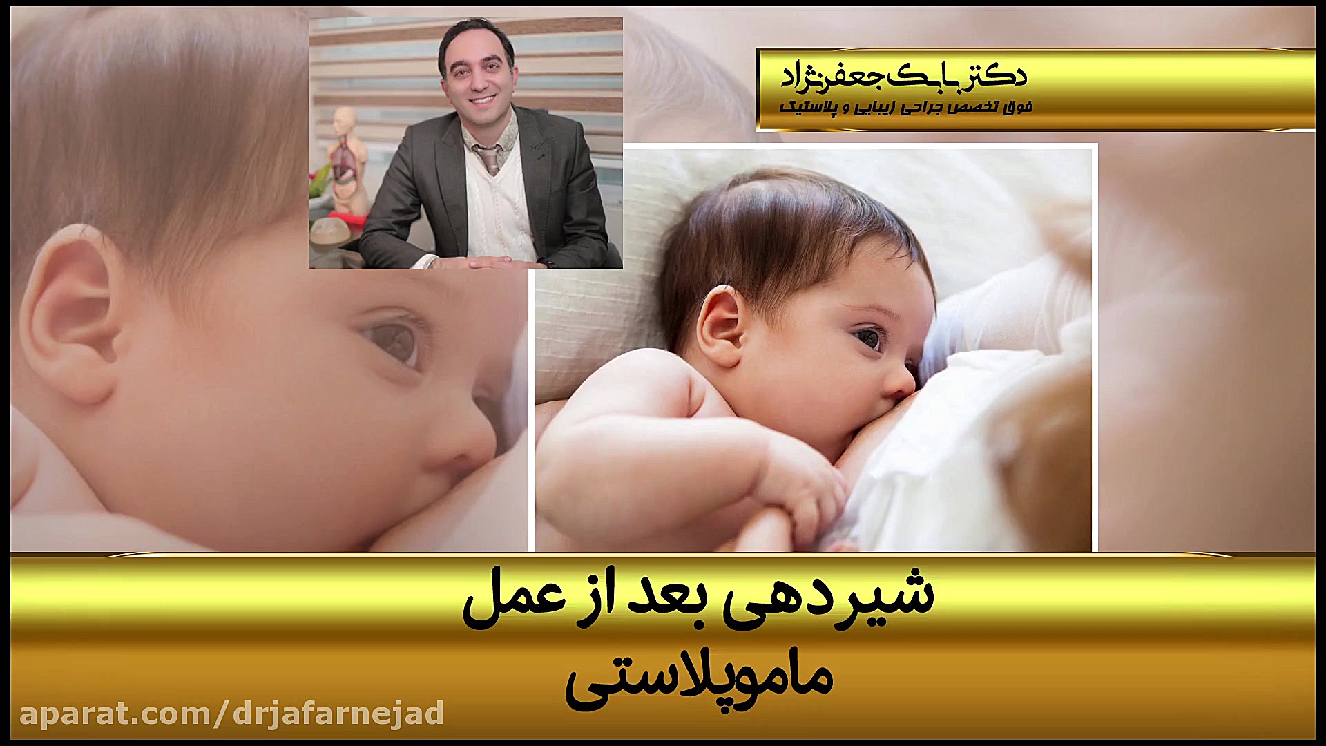 شیردهی بعد از ماموپلاستی دکتر بابک جعفرنژاد