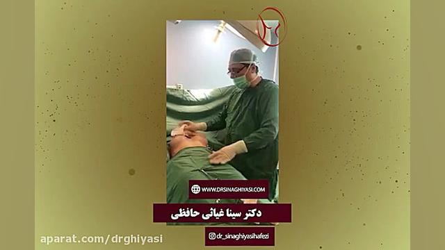 پروتز سینه به شکل توبورس یا بوقی شکل دکتر سینا غیاثی حافظی