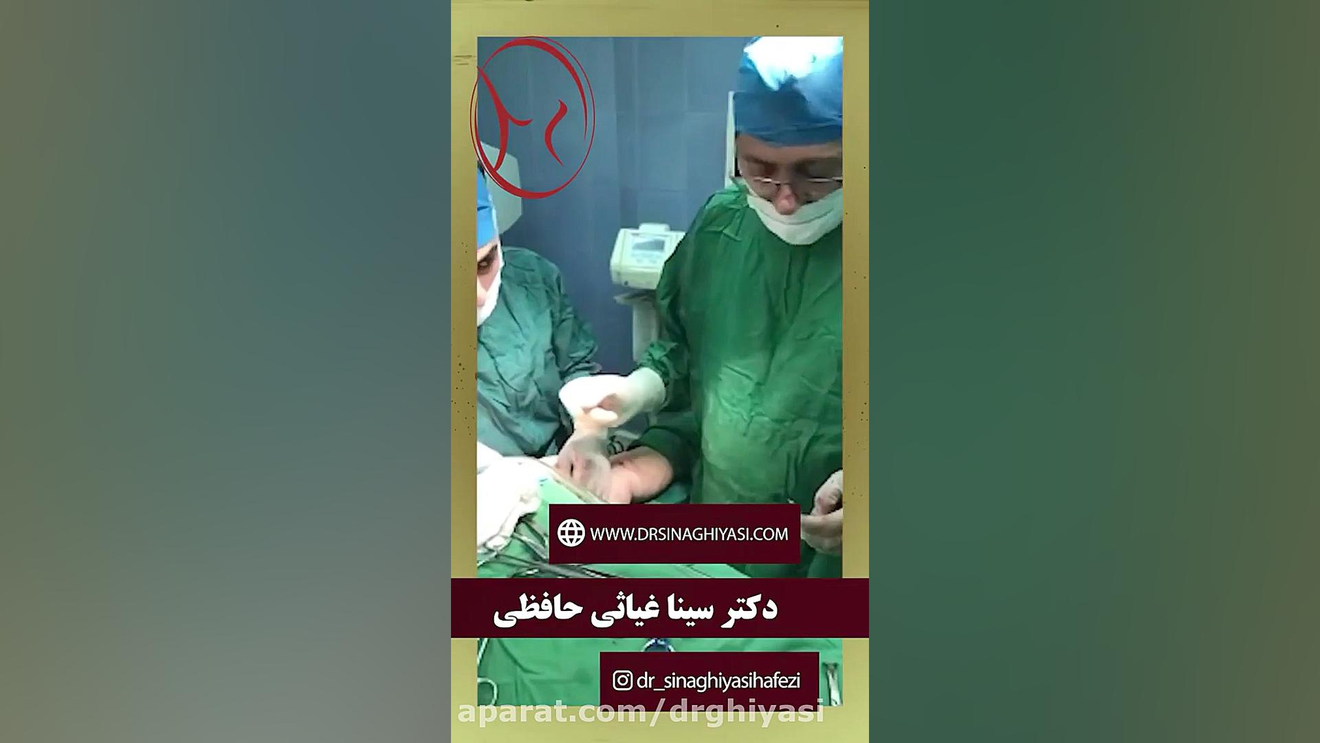 جراحی لیفت بازو دکتر سینا غیاثی حافظی