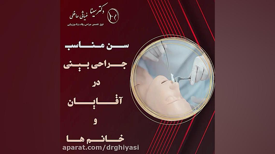 سن مناسب جراحی بینی در آقایان و بانوان دکتر سینا غیاثی حافظی