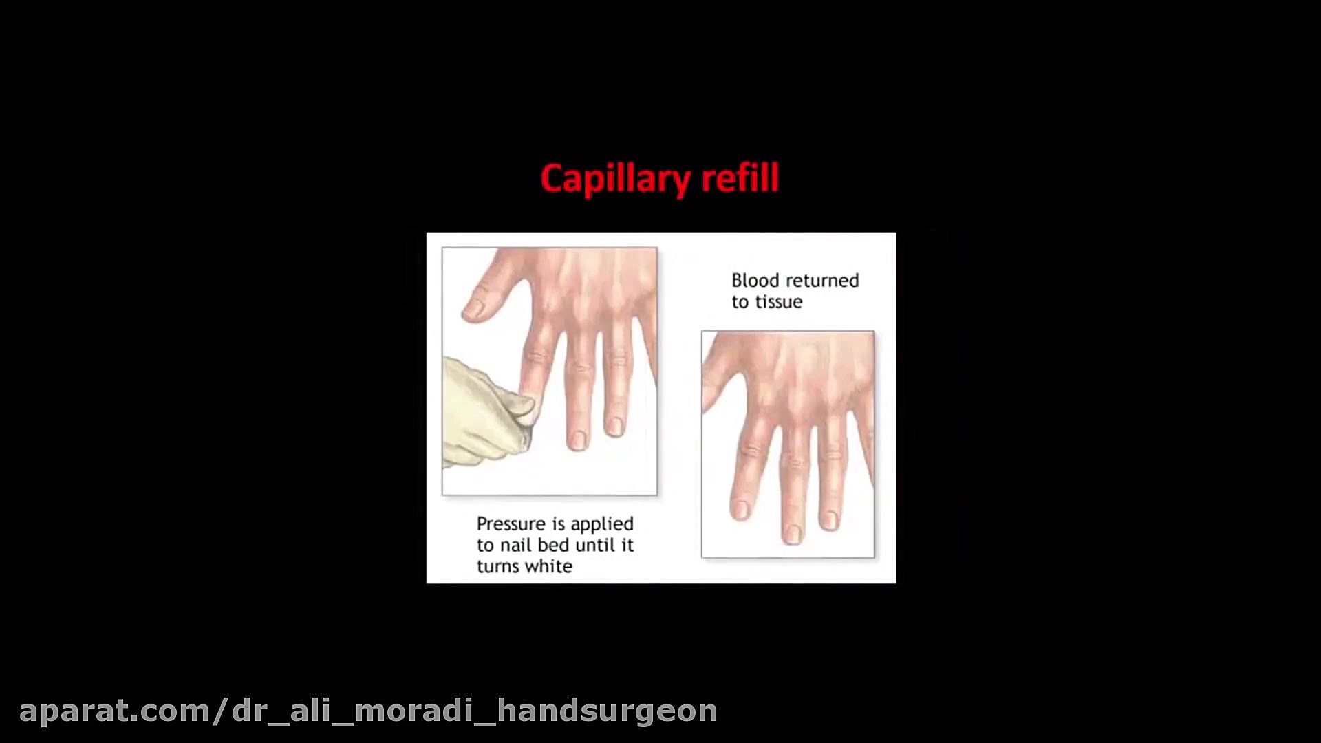 Vascular Examination Disease دکتر علی مرادی جراح دست