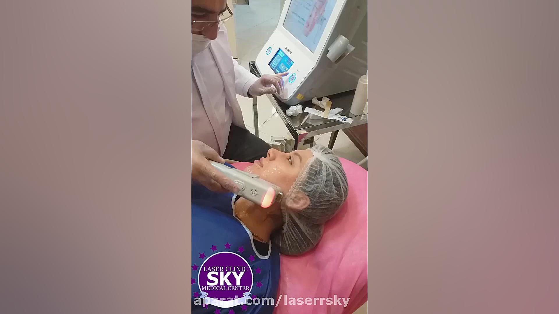 فیلم هایفوتراپی صورت و گردن اوتیلومیومبر