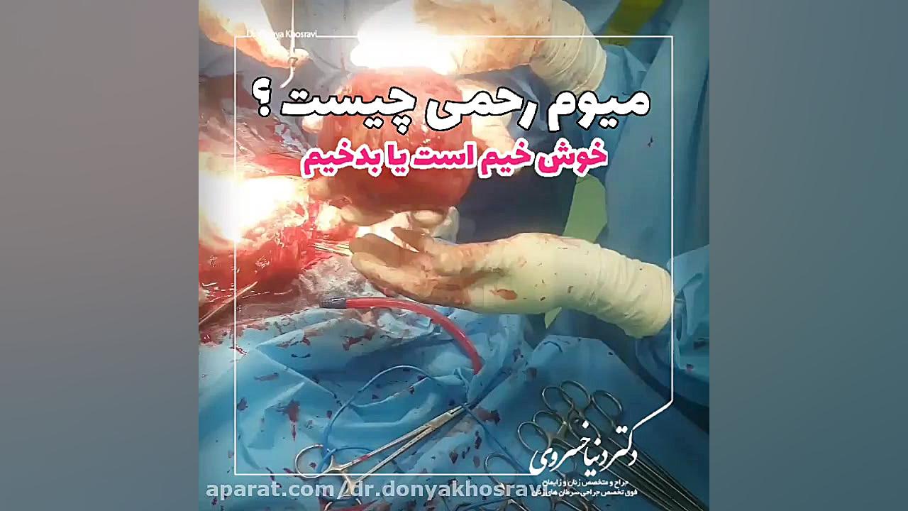 میوم رحمی چیست ؟ دکتر دنیا خسروی