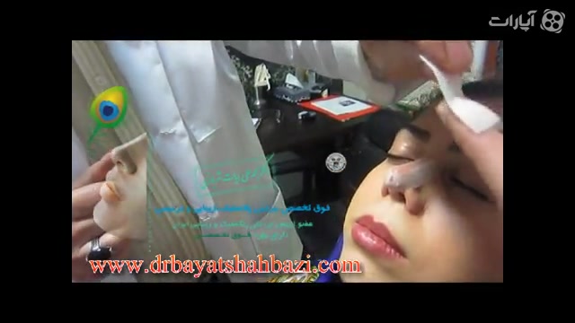 آموزش چسب زدن بینی عمل شده دکتر محمد علی بیات شهبازی فوق تخصص زیبایی