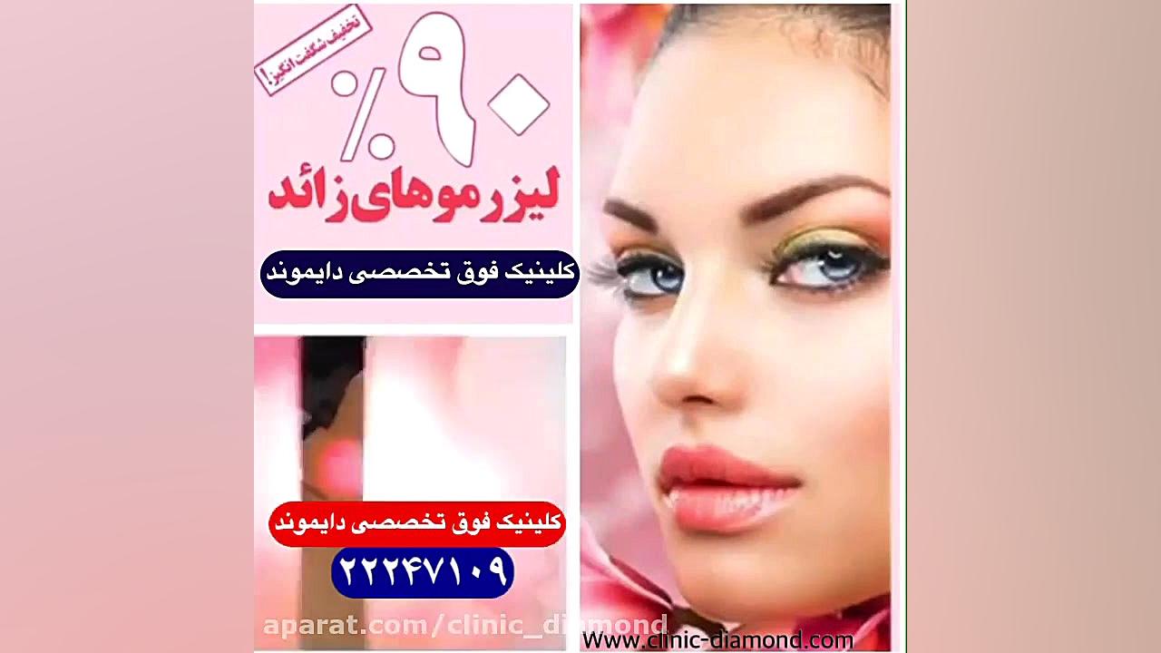 تخفیف لیزر کل بدن - کلینیک لیزر دایموند قیطریه لمینت