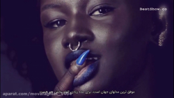 5 انسان با رنگ پوست منحصر بفرد