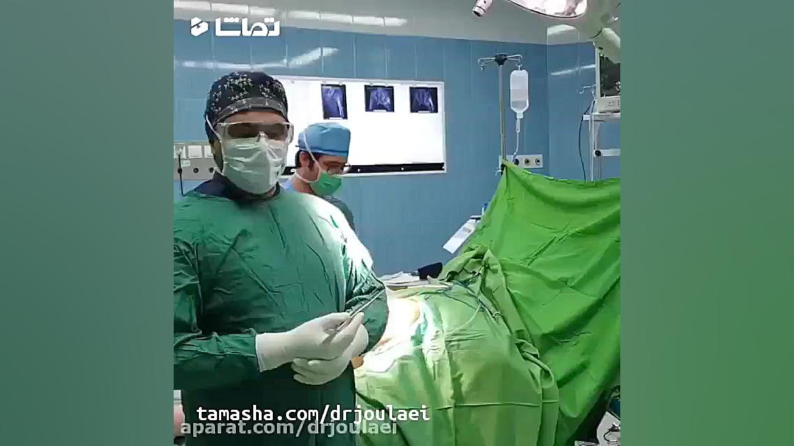 جراحی شکستگی لگن شلخته خان