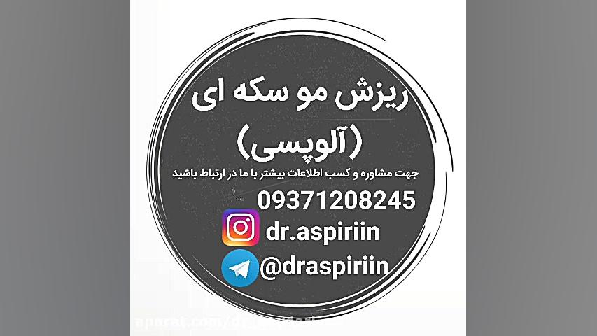 درمان ریزش مو (آلوپسی)کاملا گیاهی و تضمینی!!! تست آنتی‌بادی مونوکلونال